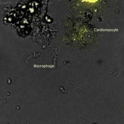 Macrophages and Myocardial Metabolism