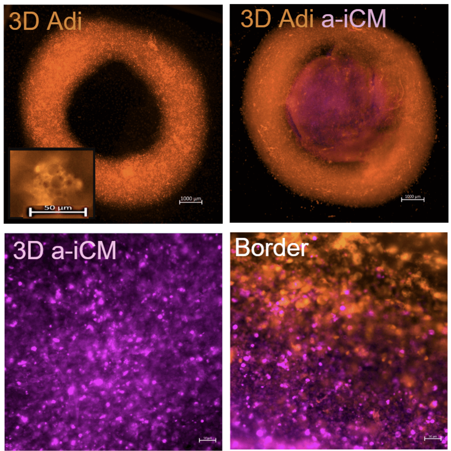 Engineered Fat-Myocardium Model to Study the Role of Obesity in Myocardial Dysfunction