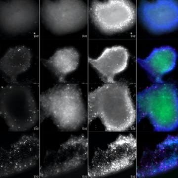 Novel 3D Bioprinting Breast Cancer Models