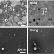 Matrix Bound Vesicles